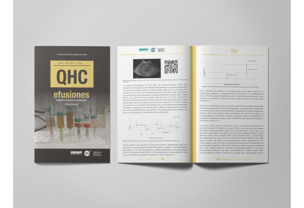 Revista QHC Efusiones -Que Hacer Con...
