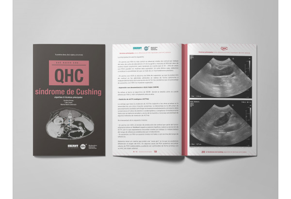 Revista QHC Síndrome de Cushing -Que Hacer Con...