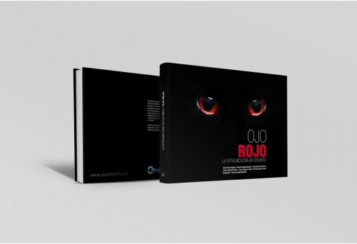 Ojo rojo. La oftalmologí­a en colores -Manuales prácticos