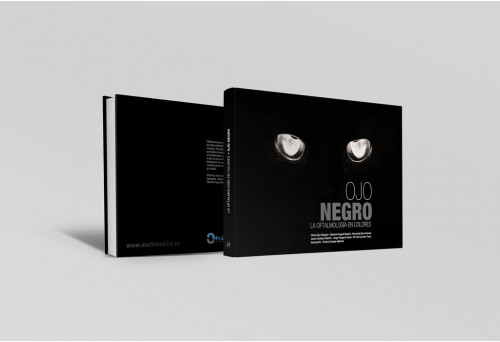 Ojo negro. La oftalmologí­a en colores -Manuales prácticos